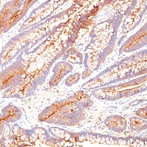 Carcinoembryonic Antigen (CEA) / CD66; Clone SPM584 (Concentrate)